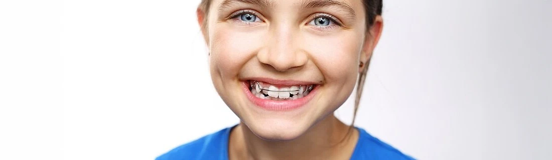 a girl in a blue shirt is smiling with a visible retainer