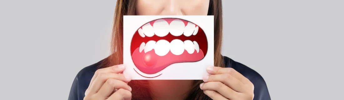photo of a woman holding up an illustration of a mouth with an inflamed gumline