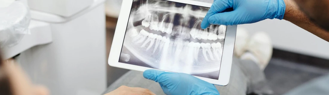 Dentist Lewiston ME Restorative Dentistry a close up photo of a dentist pointing at a mouth x-ray and showing it to a patient