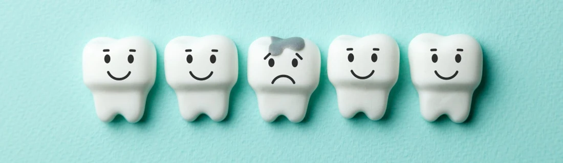 Dentist Lewiston ME Sealants four cartoony teeth are seen smiling with a sad one in the middle with a cavity