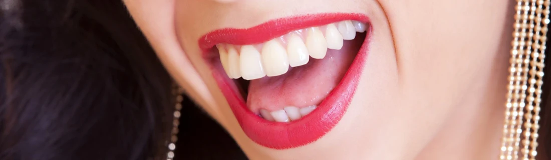 Dentist Lewiston ME Smile Makeover close up of a woman with a dazzling smile and red lipstick is laughing